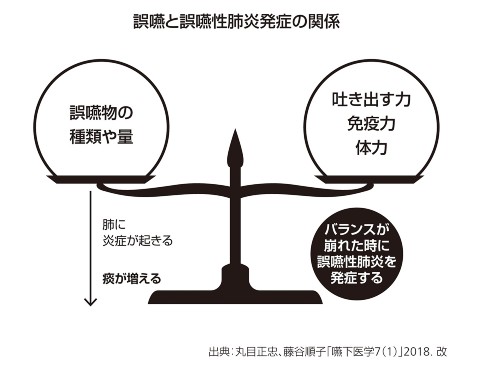 嚥 死亡 まで 性 肺炎 誤 肺炎こそが最後のハードル！ 恐ろしい誤嚥性肺炎の「負のスパイラル」：誤嚥性肺炎の脅威から身を守る：日経Gooday（グッデイ）