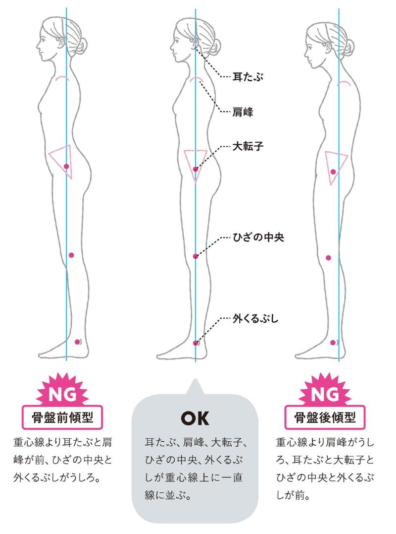 横向きの女性のイラスト。骨盤前傾型、骨盤後傾型、正しい姿勢。